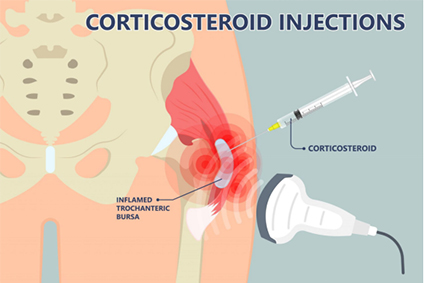 The Risks of Timing: Corticosteroid Injections and Postoperative Infection After Hip Arthroscopy